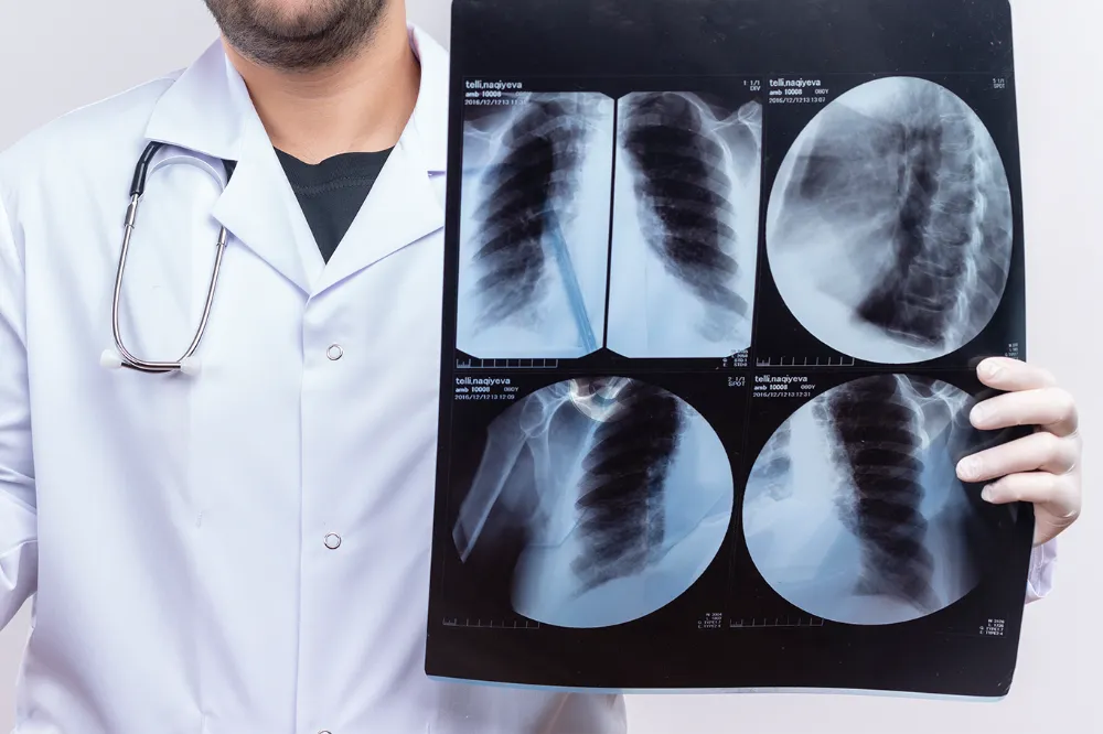 Karaciğer kanserinin tetikleyicileri: Aşırı obezite, alkol ve sigara