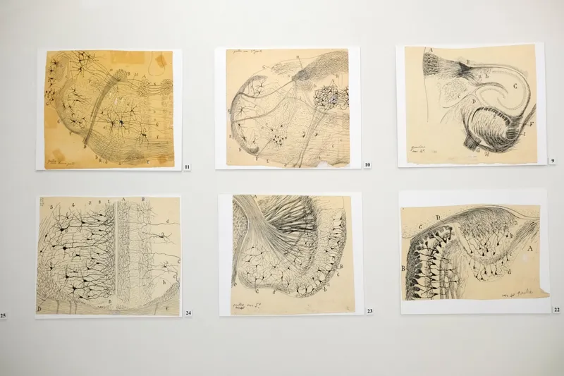 Migrenin kökeni aydınlanıyor: NÖROM’dan bağırsak–beyin eksenini gösteren çarpıcı bulgular