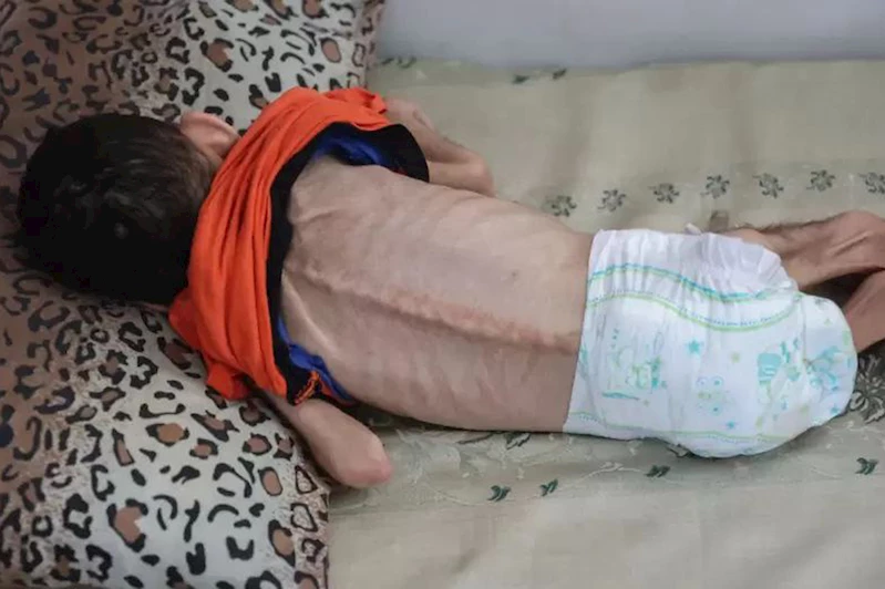 BM: Gazze’de açlık, hastalık ve toplu ölümler kapıda