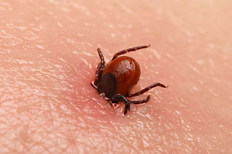 Kene ısırmalarında yanlış müdahale ölümle sonuçlanabilir