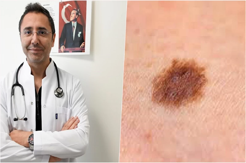 Uzmandan cilt kanseri uyarısı