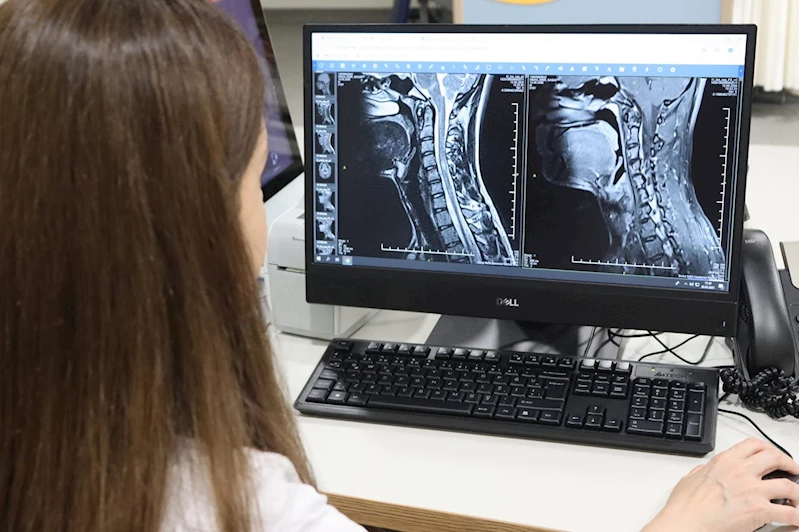 Uzmanından uyarı: Multiple Skleroz her hastada farklı seyrediyor