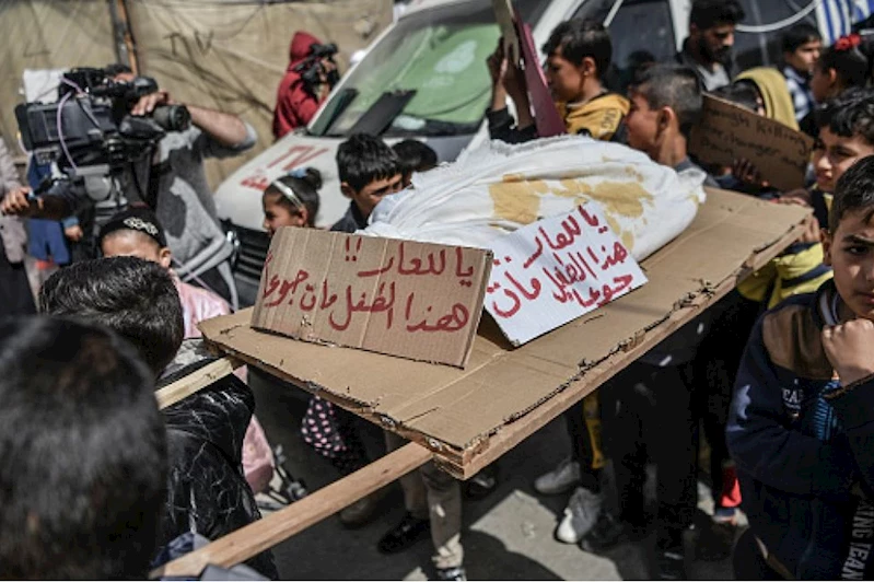 Gazze Sağlık Müdürü, açlık ve yetersiz beslenme mağdurlarının sayısının arttığı konusunda uyardı