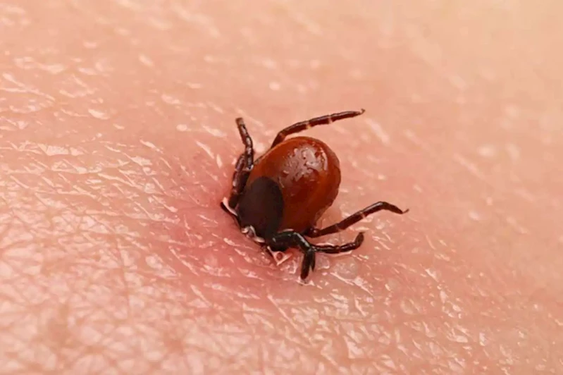 Sivas’ta KKKA şüphesiyle bir kişi daha hayatını kaybetti