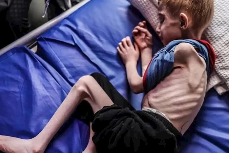 Gazze’de açlıktan dolayı şehit olanların sayısı 263’e yükseldi