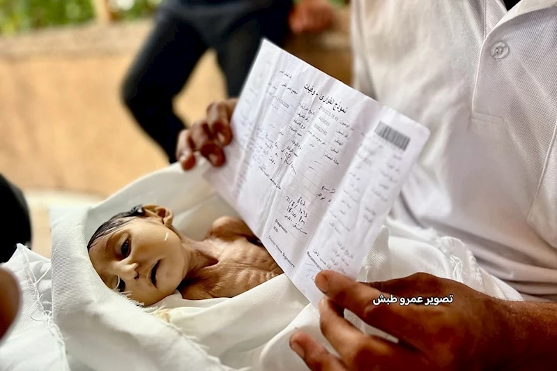 Gazze’de 5 aylık bebek yetersiz beslenme nedeniyle şehid oldu