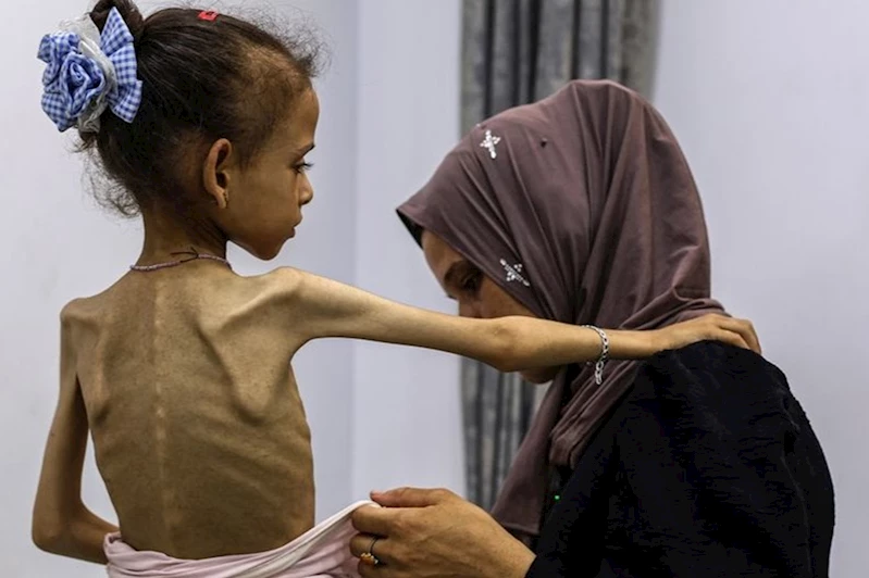 UNRWA: Yardım girişine derhal izin verilerek Gazze’deki açlık durdurulabilir