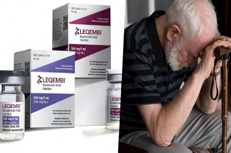 Alzheimer ilacı “Lecanemab” eylülde Almanya’da