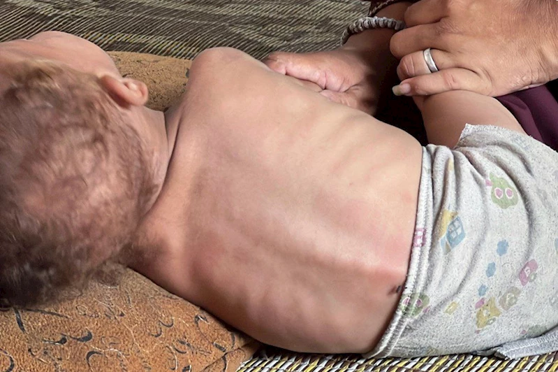 Son 24 saatte Gazze’de açlıktan 11 kişi daha şehid oldu