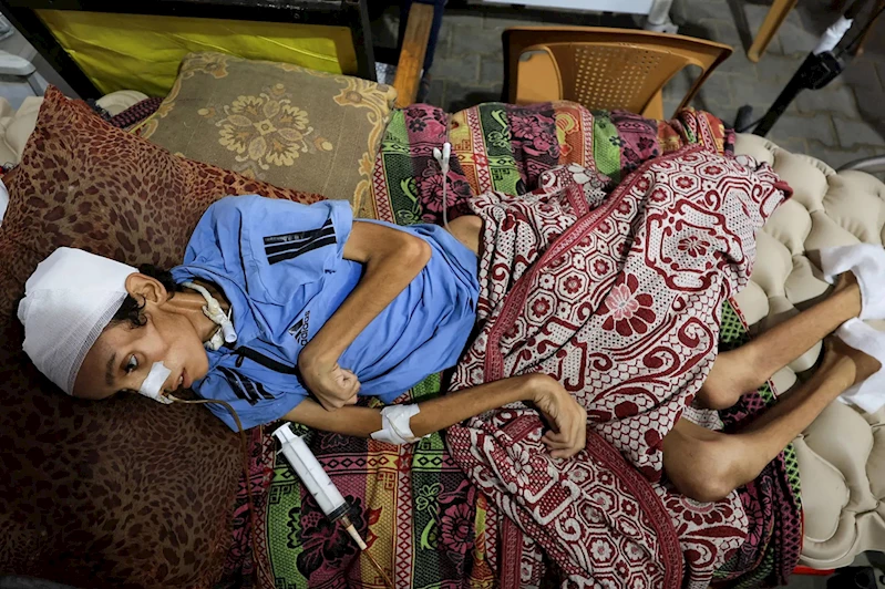 Gazze açlıktan ölüyor: 9 kişi daha açlıktan hayatını kaybetti