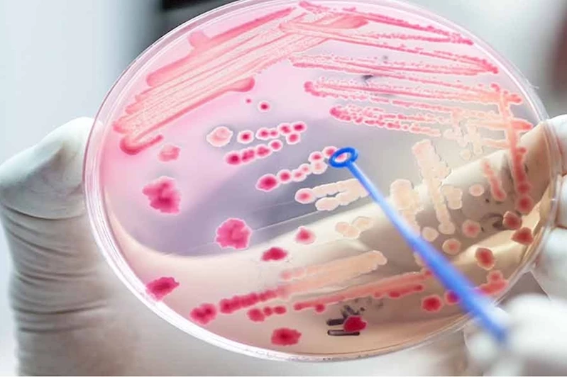 Sepsis her yıl 30 milyondan fazla insanı etkiliyor