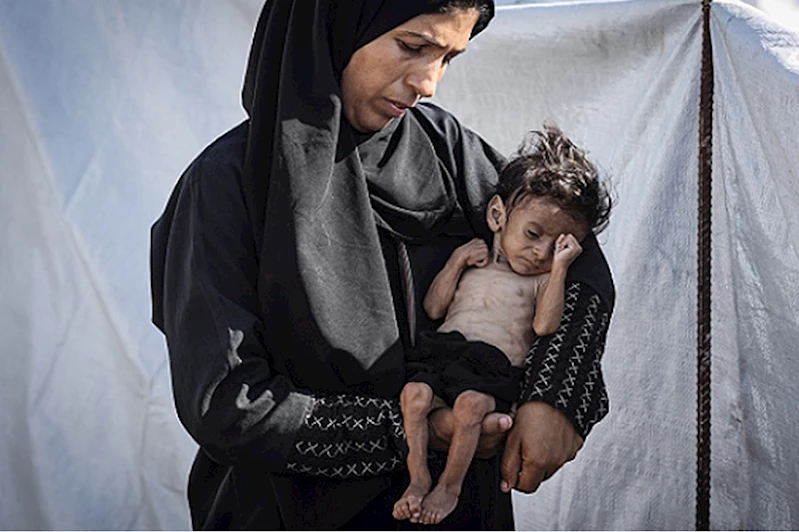 Gazze’de 2 kişi daha açlık nedeniyle şehit oldu