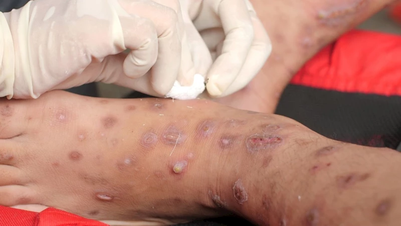 Veteriner Hekim Mustafa Yıldız: 