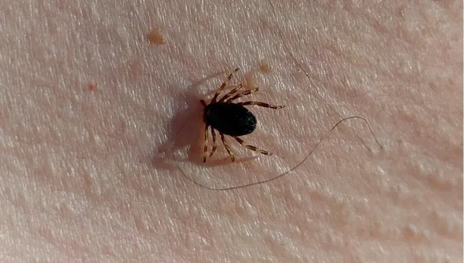 Türkiye’de Kene Vakaları Arttı 