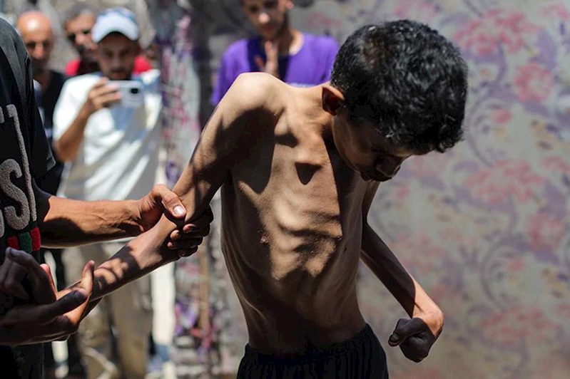 Gazze’de son 24 saatte açlıktan 2 kişi daha şehit oldu