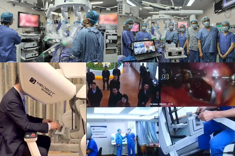 Çin ve Fransa arasında 10 Bin kilometrelik bağlantıyla karaciğer kanseri ameliyatı